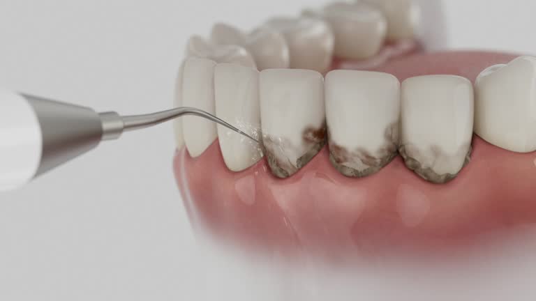 Trusted Dental Implants service in Vista Santa Rosa, CA - Dentist Open Now